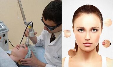 كيف يتم تجديد الجلد بالليزر؟